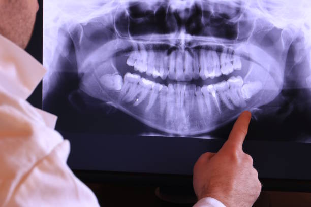 Best Emergency Dental Extractions in Wanamassa, NJ